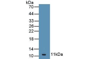 Detection of Recombinant AGTR2, Human using Polyclonal Antibody to Angiotensin II Receptor 2 (AGTR2) (Angiotensin II Type 2 Receptor antibody)