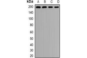 Western blot analysis of Clathrin Heavy Chain expression in Hela (A), MCF7 (B), mouse lung (C), rat brain (D) whole cell lysates. (Clathrin Heavy Chain (CLTC) antibody)