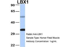 Host: Rabbit Target Name: LBX1 Sample Type: Human Fetal Muscle Antibody Dilution: 1. (Lbx1 antibody  (Middle Region))