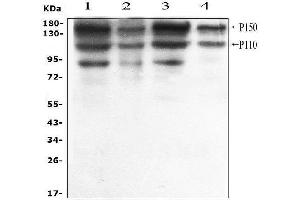 Western blot analysis of ADAR1 using anti-ADAR1 antibody (ABIN4886426). (ADAR antibody  (AA 128-346))