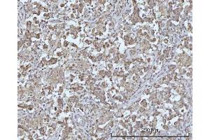IHC analysis of ODF2L using anti-ODF2L antibody (ABIN7601202). (ODF2L antibody  (AA 3-610))