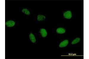 Immunofluorescence of purified MaxPab antibody to TAF6L on HeLa cell. (TAF6L antibody  (AA 1-459))