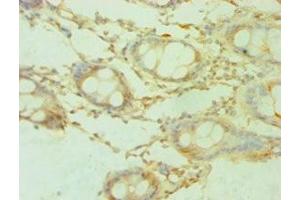 Immunohistochemistry of paraffin-embedded human colon tissue using ABIN7168889 at dilution of 1:100 (SHMT1 antibody  (AA 324-483))