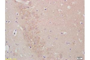 Formalin-fixed and paraffin embedded rat brain labeled with Anti--LIS1 Polyclonal Antibody, Unconjugated (ABIN676868) at 1:200, followed by conjugation to the secondary antibody and DAB staining