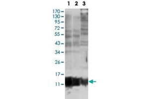 Western blot analysis of S100A10 monoclonal antobody, clone 4E7E10  against MCF-7 (1), HepG2 (2) and HeLa (3).
