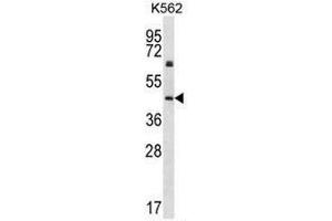 KRT12 Antibody (C-term) western blot analysis in K562 cell line lysates (35µg/lane).