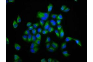 Immunofluorescence staining of Hela cells with ABIN7152990 at 1:133, counter-stained with DAPI. (FOLR2 antibody  (AA 35-167))