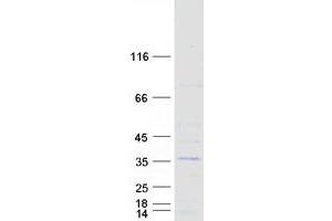 Validation with Western Blot (SSX5 Protein (Transcript Variant 1) (Myc-DYKDDDDK Tag))