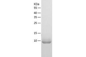BOLA3 Protein (AA 1-107) (His tag)