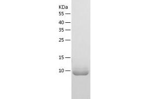 Western Blotting (WB) image for BolA Homolog 3 (BOLA3) (AA 1-107) protein (His tag) (ABIN7287470) (BOLA3 Protein (AA 1-107) (His tag))