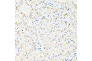 Immunohistochemistry of paraffin-embedded mouse kidney using SUMO1 Antibody (ABIN5971157) at dilution of 1/200 (40x lens). (SUMO1 antibody)