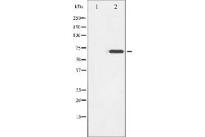 Western blot analysis of ZAP-70 phosphorylation expression in Jurkat whole cell lysates,The lane on the left is treated with the antigen-specific peptide. (ZAP70 antibody  (pTyr319))