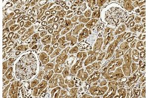 Immunohistochemical analysis of paraffin-embedded Human kidney section using Pink1 am8437c. (ULK3 antibody  (C-Term))