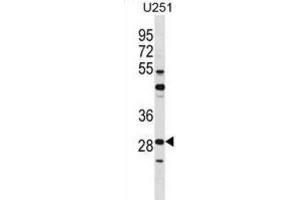 Western Blotting (WB) image for anti-FOS-Like Antigen 2 (FOSL2) antibody (ABIN2998778) (FOSL2 antibody)
