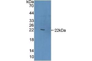 Detection of Recombinant CLEC10A, Human using Polyclonal Antibody to Cluster Of differentiation 301 (CD301) (CLEC10A antibody  (AA 71-239))