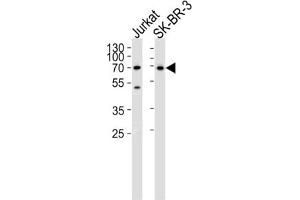 Western Blotting (WB) image for anti-CD46 (CD46) antibody (ABIN3002132) (CD46 antibody)