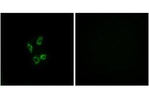 Immunofluorescence analysis of HuvEc cells, using Cytochrome P450 4Z1 Antibody. (CYP4Z1 antibody  (AA 71-120))