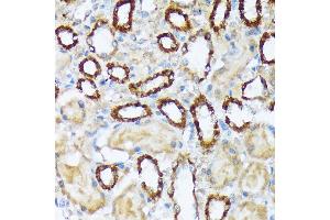 Immunohistochemistry of paraffin-embedded rat kidney using W/W/W Rabbit mAb (ABIN7271346) at dilution of 1:100 (40x lens). (WASF2 antibody)