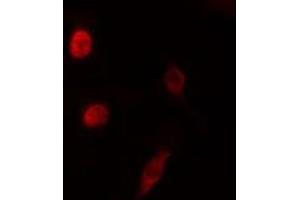 ABIN6276550 staining HeLa cells by IF/ICC. (NEUROD1 antibody  (N-Term))
