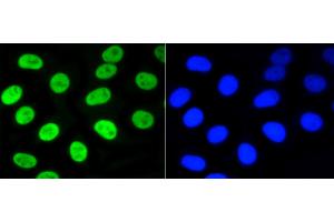 HepG2 cells were stained with Nrf2(S40) (7G4) Monoclonal Antibody  at [1:200] incubated overnight at 4C, followed by secondary antibody incubation, DAPI staining of the nuclei and detection. (NRF2 antibody  (pSer40))