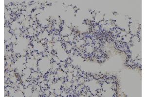 ABIN6277771 at 1/100 staining Mouse lung tissue by IHC-P. (CSNK2A1/CK II alpha antibody  (N-Term))