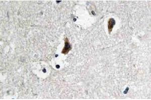 Immunohistochemistry (IHC) analyzes of c-Src antibody in paraffin-embedded human brain tissue.