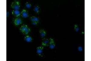 Immunofluorescence (IF) image for anti-Hydroxyacid Oxidase (Glycolate Oxidase) 1 (HAO1) antibody (ABIN1498576)