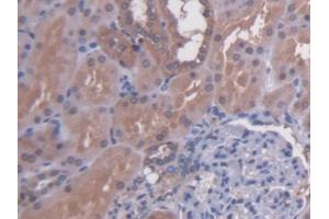 DAB staining on IHC-P; Samples: Human Kidney Tissue (N-Acetyl alpha-D-Glucosaminidase (AA 485-743) antibody)