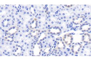 Detection of Kim1 in Rat Kidney Tissue using Monoclonal Antibody to Kidney Injury Molecule 1 (Kim1) (HAVCR1 antibody  (AA 22-235))