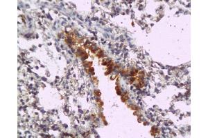Formalin-fixed and paraffin embedded mouse lung tissue labeled with Anti-MyD88 Polyclonal Antibody, Unconjugated  at 1:200, followed by conjugation to the secondary antibody and DAB staining (MYD88 antibody  (AA 201-296))