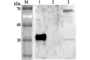 Western blot analysis using anti-ANGPTL4 (human), pAb  at 1:2'000 dilution. (ANGPTL4 antibody)