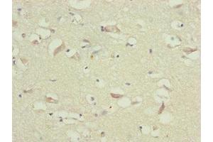 Immunohistochemistry of paraffin-embedded human brain tissue using ABIN7173719 at dilution of 1:100 (TTLL7 antibody  (AA 1-260))