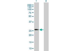 Western Blot analysis of C1QTNF5 expression in transfected 293T cell line by C1QTNF5 MaxPab polyclonal antibody. (CTRP5 antibody  (AA 1-243))