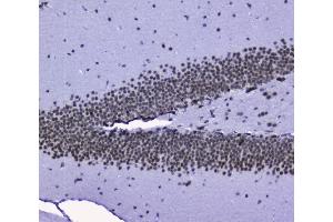 IHC analysis of nmt55/p54nrb using anti-nmt55/p54nrb antibody (ABIN3044530). (NONO antibody  (N-Term))
