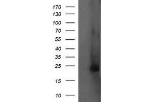 Image no. 2 for anti-Fetal and Adult Testis Expressed 1 (FATE1) antibody (ABIN1498223) (FATE1 antibody)