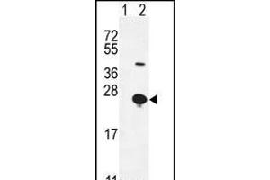 Western blot analysis of EPGN (arrow) using rabbit polyclonal EPGN Antibody (N-term) (ABIN655189 and ABIN2844805). (Epigen antibody  (N-Term))