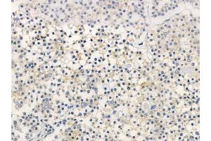 ABIN6261574 and ABIN6266963 at 1/100 staining human pituitary adenoma by IHC-P. (Epsin 1 antibody  (Internal Region))