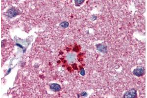 Human Brain, Cortex, Senile Plaque (formalin-fixed, paraffin-embedded) stained with TCF21 antibody ABIN462190 followed by biotinylated goat anti-rabbit IgG secondary antibody ABIN481713, alkaline phosphatase-streptavidin and chromogen. (TCF21 antibody  (AA 42-91))