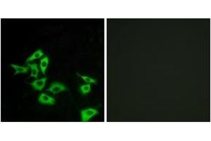 Immunofluorescence analysis of A549 cells, using FZD8 Antibody. (FZD8 antibody  (AA 31-80))