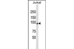 Western blot analysis of PLCL1 Antibody (N-term) (ABIN652796 and ABIN2842522) in Jurkat cell line lysates (35 μg/lane). (PLCL1 antibody  (N-Term))