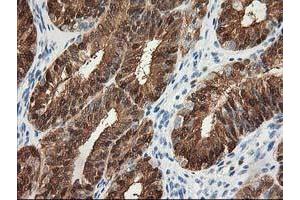 Image no. 1 for anti-Hydroxyprostaglandin Dehydrogenase 15-(NAD) (HPGD) antibody (ABIN1496363) (HPGD antibody)