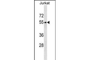 SEPT6 Antibody (C-term) (ABIN1537277 and ABIN2850133) western blot analysis in Jurkat cell line lysates (35 μg/lane). (Septin 6 antibody  (C-Term))