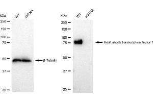 Western blotting analysis using Heat shock transcription factor 1 antibody (ABIN7798861). (Recombinant HSF1 antibody)