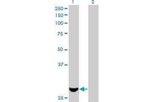 Western Blot analysis of PMM2 expression in transfected 293T cell line by PMM2 monoclonal antibody (M01), clone 2E9.