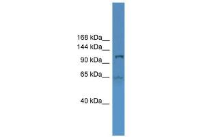 WB Suggested Anti-UBA6 Antibody Titration: 0.