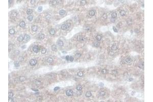 DAB staining on IHC-P; Samples: Rat Liver Tissue) (ORM1 antibody  (AA 19-186))