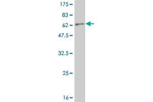Western Blot detection against Immunogen (67. (SERPINA6 antibody  (AA 23-405))