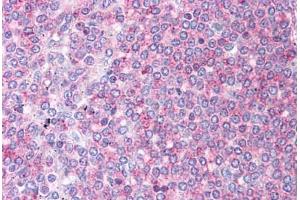 Immunohistochemistry (Formalin-fixed Paraffin-embedded Sections) (IHC (fp)) image for anti-Dihydrolipoamide Branched Chain Transacylase E2 (DBT) (AA 35-84) antibody (ABIN6745750)