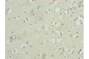 Immunohistochemistry of paraffin-embedded human brain tissue using ABIN7176547 at dilution of 1:100 (ZNF821 antibody  (AA 1-370))