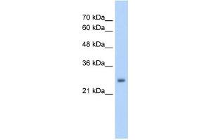 NELF antibody used at 5 ug/ml to detect target protein. (NMDA Receptor Synaptonuclear Signaling and Neuronal Migration Factor (NSMF) (Middle Region) antibody)